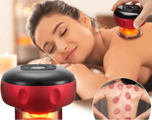 Electric Cupping Massager